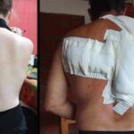 ¡Terror en el Barrio Ramírez! Una violenta gresca a machetazos dejó a una familia herida y con amenazas de muerte